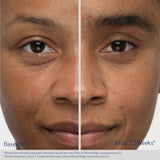 OBAGI NU_CIL SERUM POTENCIADOR DE CEJAS