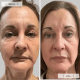 OMNILUX CONTORNO FACIAL