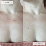 OMNILUX CONTORNO CUELLO & ESCOTE