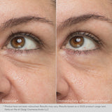 GEL-CREMA REJUVENECEDOR PARA EL CONTORNO DE OJOS -GOTAS DIARIAS