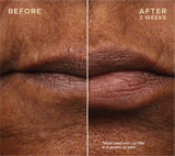 DÚO RELLENADOR/ACONDICIONADOR LABIAL