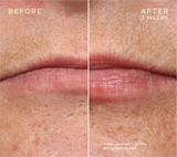 DÚO RELLENADOR/ACONDICIONADOR LABIAL