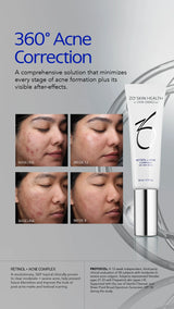 COMPLEJO RETINOL + ACNÉ