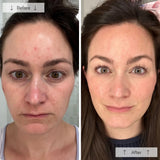 OMNILUX CONTORNO FACIAL