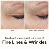 Suero INTENSE con recubrimiento