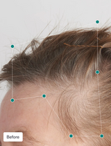 NUTRAFOL WOMEN'S BALANCE HAIR GROWTH PACK