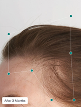 NUTRAFOL WOMEN'S BALANCE HAIR GROWTH PACK