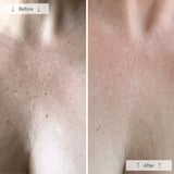 OMNILUX CONTORNO CUELLO & ESCOTE